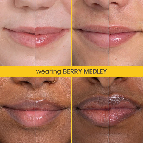 Rescue Lip Relief